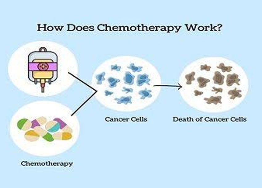 Chemotherapy